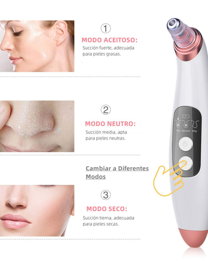 Extractor de puntos negros